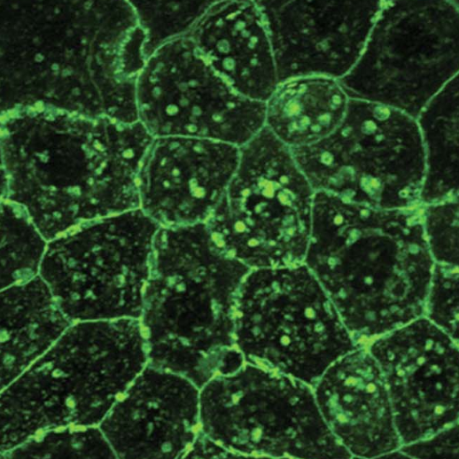 Cell size in myovb morphants