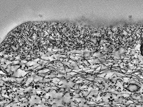 microridge cross section EM