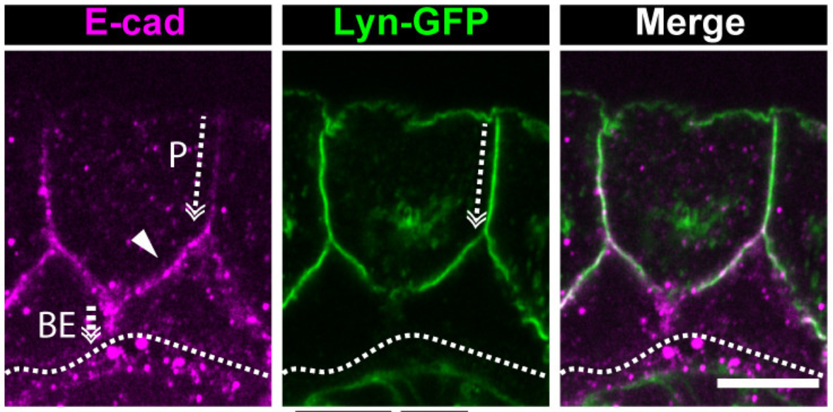 Polarized distribution of Ecadherin in bilayered epithelia